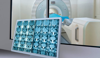 固定装具の作成と治療計画用CTの撮影